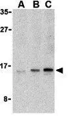 Anti-UEV1A antibody used in Western Blot (WB). GTX85082