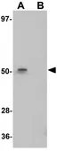 Anti-ENC1 antibody used in Western Blot (WB). GTX85108