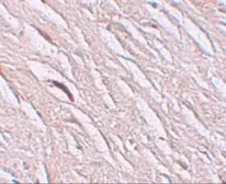 Anti-SLC39A2 antibody used in IHC (Paraffin sections) (IHC-P). GTX85134
