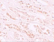 Anti-EFCAB4B antibody used in IHC (Paraffin sections) (IHC-P). GTX85142