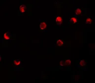 Anti-NALP11 antibody used in Immunocytochemistry/ Immunofluorescence (ICC/IF). GTX85153