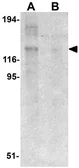 Anti-NALP8 antibody used in Western Blot (WB). GTX85155
