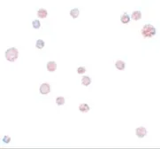 Anti-ATP11A antibody used in Immunocytochemistry/ Immunofluorescence (ICC/IF). GTX85170