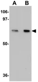 Anti-TCTN1 antibody used in Western Blot (WB). GTX85178