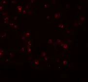 Anti-APC13 antibody used in Immunocytochemistry/ Immunofluorescence (ICC/IF). GTX85186