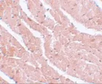 Anti-MTUS2 antibody used in IHC (Paraffin sections) (IHC-P). GTX85202