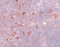 Anti-NAT11 antibody used in IHC (Paraffin sections) (IHC-P). GTX85214