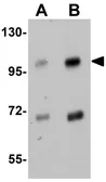 Anti-SLFN14 antibody used in Western Blot (WB). GTX85216