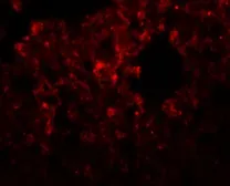 Anti-RHBDD3 antibody used in IHC (Paraffin sections) (IHC-P). GTX85218