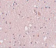 Anti-SIPA1L2 antibody used in IHC (Paraffin sections) (IHC-P). GTX85227