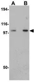 Anti-PGCC1 antibody used in Western Blot (WB). GTX85254
