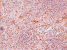 Anti-ABIN3 antibody used in IHC (Paraffin sections) (IHC-P). GTX85255