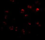Anti-KLHL15 antibody used in Immunocytochemistry/ Immunofluorescence (ICC/IF). GTX85275