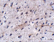 Anti-LRFN5 antibody used in IHC (Paraffin sections) (IHC-P). GTX85300