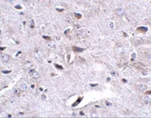 Anti-LRFN3 antibody used in IHC (Paraffin sections) (IHC-P). GTX85343