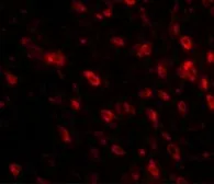 Anti-TTBK1 antibody used in IHC (Paraffin sections) (IHC-P). GTX85349
