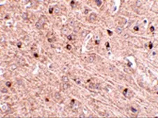 Anti-TOM70 antibody used in IHC (Paraffin sections) (IHC-P). GTX85353