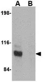 Anti-JPH3 antibody used in Western Blot (WB). GTX85366