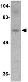 Anti-Dact3 antibody used in Western Blot (WB). GTX85372