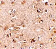 Anti-Nanos2 antibody used in IHC (Paraffin sections) (IHC-P). GTX85391