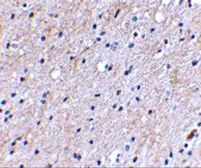 Anti-NIPSNAP antibody used in IHC (Paraffin sections) (IHC-P). GTX85407