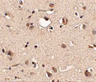 Anti-Slitrk3 antibody used in IHC (Paraffin sections) (IHC-P). GTX85416