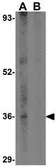 Anti-CCDC98 antibody used in Western Blot (WB). GTX85433