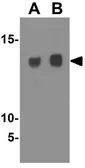 Anti-SLPI antibody used in Western Blot (WB). GTX85436