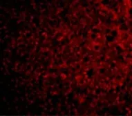 Anti-CRLF2 antibody used in IHC (Paraffin sections) (IHC-P). GTX85439