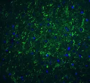 Anti-PD-L2 antibody used in IHC (Paraffin sections) (IHC-P). GTX85449