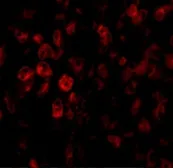 Anti-SCO2 antibody used in IHC (Paraffin sections) (IHC-P). GTX85482
