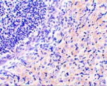 Anti-RPA Interacting Protein antibody used in IHC (Paraffin sections) (IHC-P). GTX85486