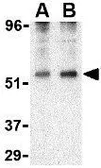 Anti-TIP47 antibody used in Western Blot (WB). GTX85491