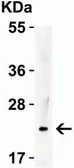 Anti-IL23 antibody used in Western Blot (WB). GTX85496