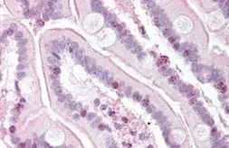 Anti-RTEL1 antibody used in IHC (Paraffin sections) (IHC-P). GTX85733