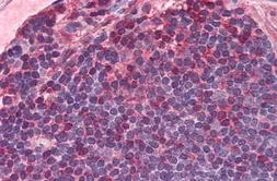 Anti-IL7 Receptor alpha antibody used in IHC (Paraffin sections) (IHC-P). GTX85865