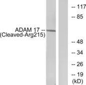 Anti-ADAM17 (cleaved Arg215) antibody used in Western Blot (WB). GTX86885