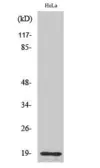 Anti-Thyroid Hormone Receptor beta (cleaved Arg327) antibody used in Western Blot (WB). GTX86914