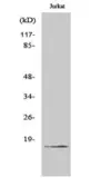 Anti-Factor VII (cleaved Arg212) antibody used in Western Blot (WB). GTX86939