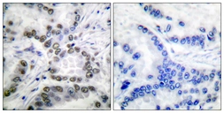 Anti-CBP (acetyl Lys1535) antibody used in IHC (Paraffin sections) (IHC-P). GTX86958