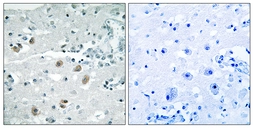 Anti-PLA2G4D antibody used in IHC (Paraffin sections) (IHC-P). GTX87029