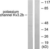 Anti-Potassium Channel Kv3.2b antibody used in Western Blot (WB). GTX87037