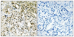 Anti-PPHLN antibody used in IHC (Paraffin sections) (IHC-P). GTX87045