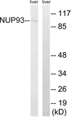 Anti-NUP93 antibody used in Western Blot (WB). GTX87060