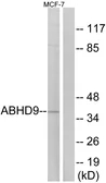 Anti-ABHD9 antibody used in Western Blot (WB). GTX87096