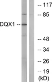 Anti-DQX1 antibody used in Western Blot (WB). GTX87145
