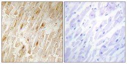 Anti-BCA3 antibody used in IHC (Paraffin sections) (IHC-P). GTX87149