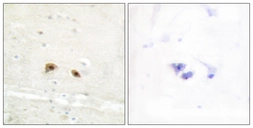 Anti-EGR3 antibody used in IHC (Paraffin sections) (IHC-P). GTX87158