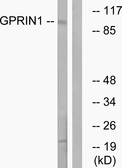 Anti-GPRIN1 antibody used in Western Blot (WB). GTX87160