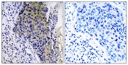 Anti-MRPL34 antibody used in IHC (Paraffin sections) (IHC-P). GTX87218